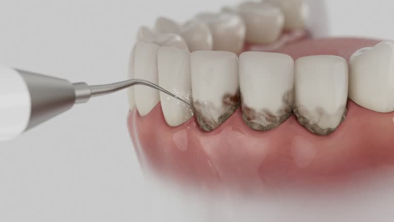 Trusted Wisdom Tooth Removal service in Maud, TX - Dentist Open Now